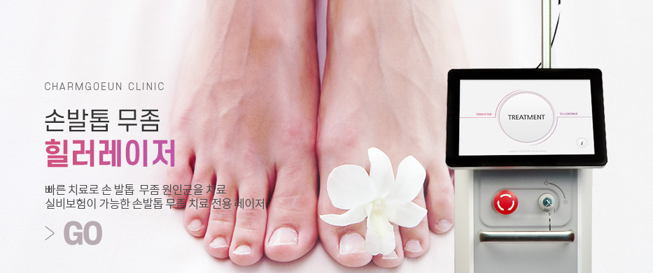 영구제모레이저