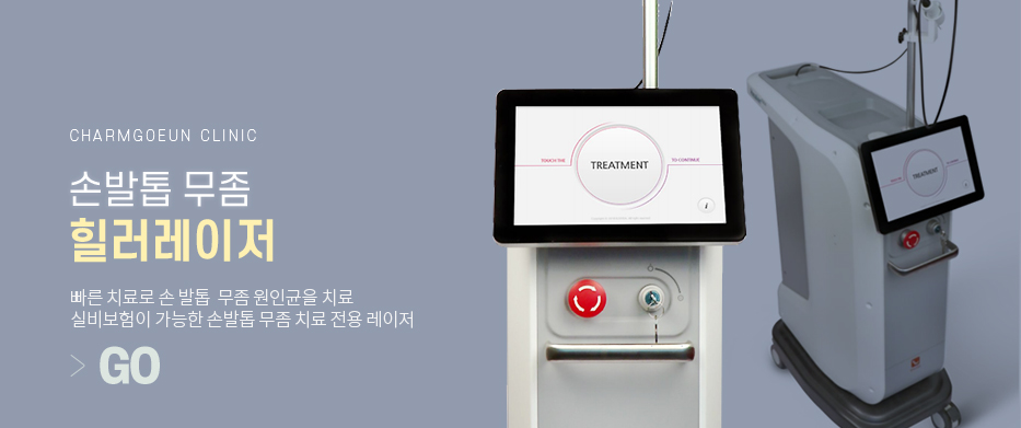 손발톱무좀